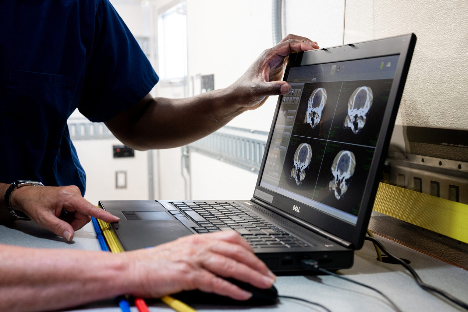 laptop with CT scan images
